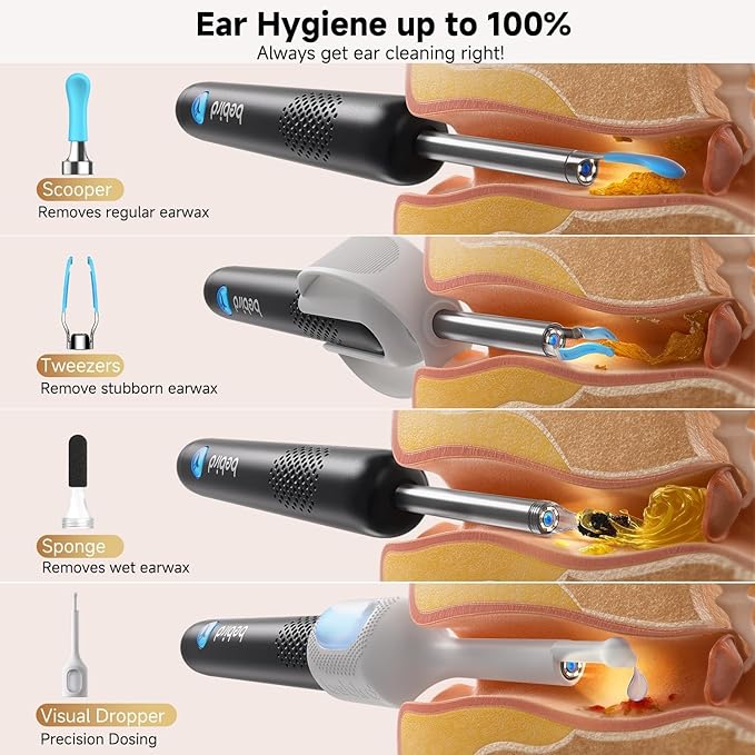 BEBIRD R1 Ultra Ear Wax Removal, Ear Cleaner with Camera Ear Scope, Wax Remove Ear Pick with Ear Otoscope Tweezers, Visual Dropper Cleaning Kit, Ear/Nose/Throat Examination Tool for Family
