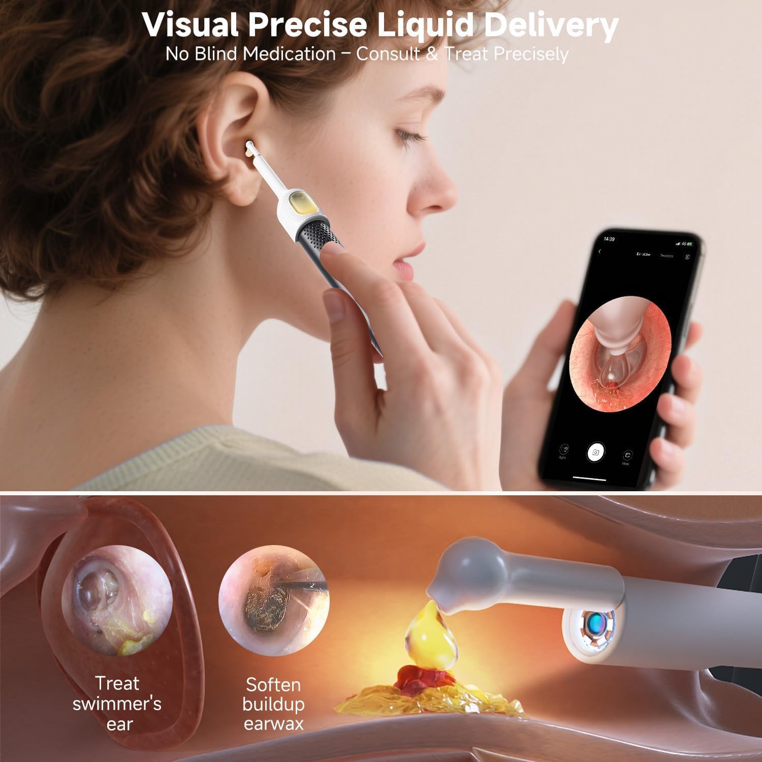BEBIRD R1 Ultra Ear Wax Removal, Ear Cleaner with Camera Ear Scope, Wax Remove Ear Pick with Ear Otoscope Tweezers, Visual Dropper Cleaning Kit, Ear/Nose/Throat Examination Tool for Family